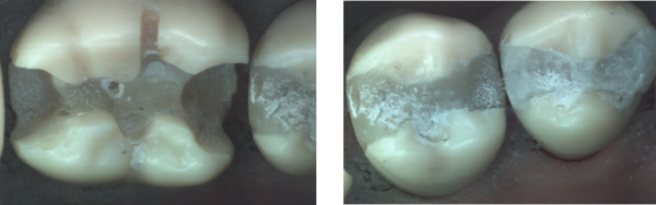 Remote software installation for Planmeca Planscan or Emerald scanners - Image 2