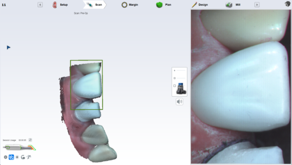 Remote software installation for Planmeca Planscan or Emerald scanners