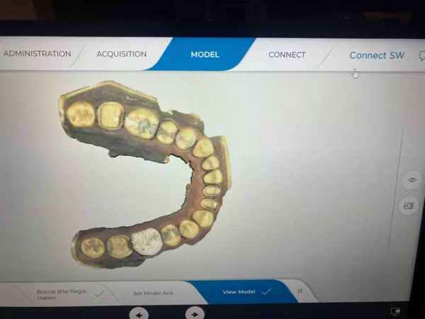 Sirona Primescan AC dental intraoral scanner (DI connect version) - Image 6