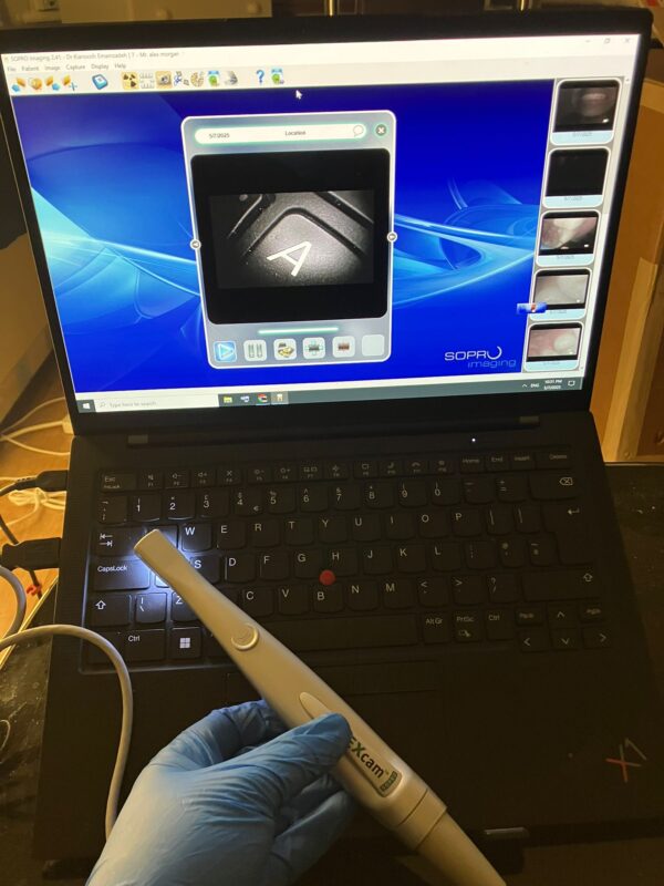 DEXcam Sopro 595 dental intraoral camera (Including USB cable) - Image 2